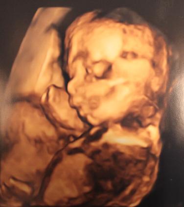 Bild zu FD- bin so beseelt... 3D-Foto - Forum für August - Mamis