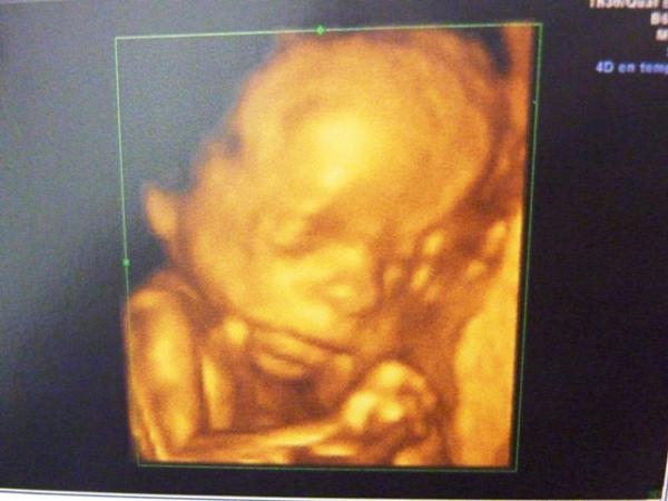 Bild zu Organscreening - Forum für August - Mamis