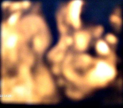 Bild zu Endlich auch wieder da :-) - Forum für August - Mamis