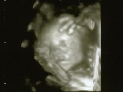 Bild zu VU + Bild - Forum für August - Mamis