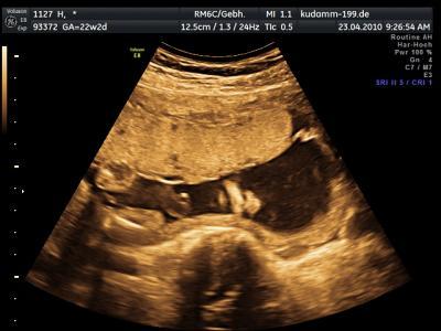 Bild zu Schaut mal... - Forum für August - Mamis