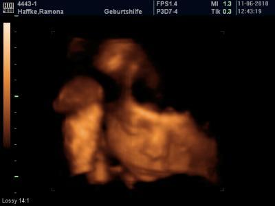 Bild zu Ich stell euch meinen süssen zwerg vor!!! - Forum für August - Mamis