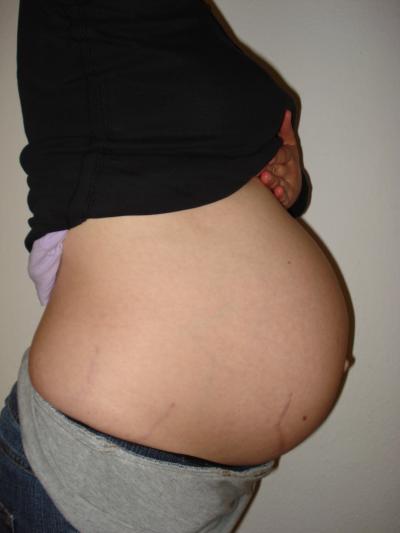 Bild zu Fehlalarm !!! - Forum für August - Mamis