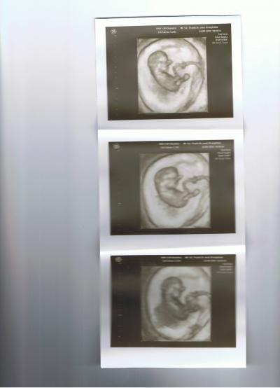 Bild zu Schaut mal-der kleine Gummibär... - Forum für August - Mamis