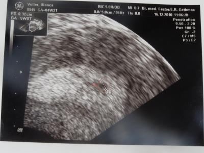 Bild zu Gestern beim Fa und Er hat schon was gesehen aber ..... - Forum für August - Mamis