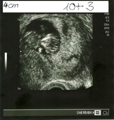 Bild zu BabyTV, komischer Verspecher und berufliche Frage :D - Forum für August - Mamis