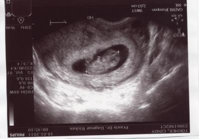 Bild zu Möchte auch mal mein Krümel zeigen - Forum für August - Mamis