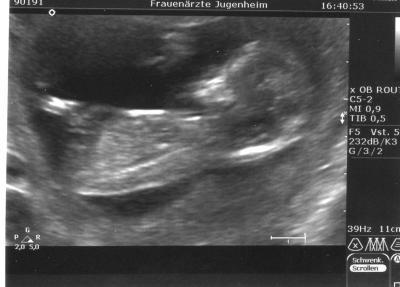 Bild zu Zurück vom FA - Forum für August - Mamis