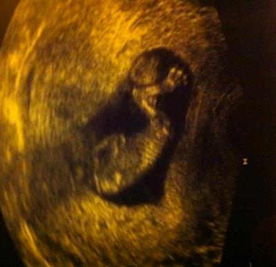 Bild zu Wissen schon was es wird... + Namensumfrage ;) - Forum für August - Mamis