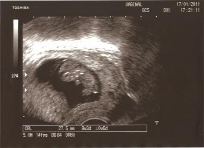 Bild zu Hallo August-Mamis! - Forum für August - Mamis