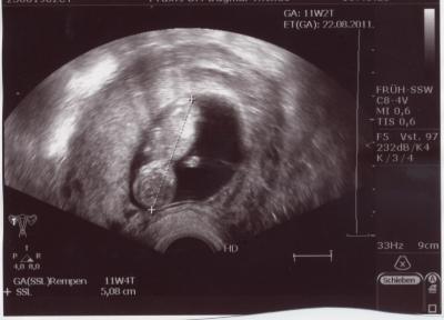 Bild zu Bild von heute - Forum für August - Mamis