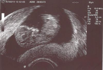 Bild zu 1.große VU geschafft *jipppih* - Forum für August - Mamis
