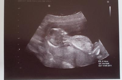 Bild zu Hier noch mein US-Bild von heute!! - Forum für August - Mamis