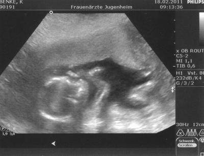 Bild zu Habe Foto vergessen - Forum für August - Mamis