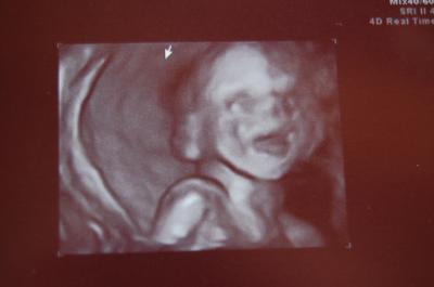 Bild zu Gestern... - Forum für August - Mamis