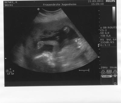 Bild zu das versprochene Foto - Forum für August - Mamis