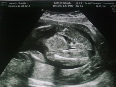 Bild zu Juhuuuuu OUTING + Bildchen!!! =) - Forum für August - Mamis