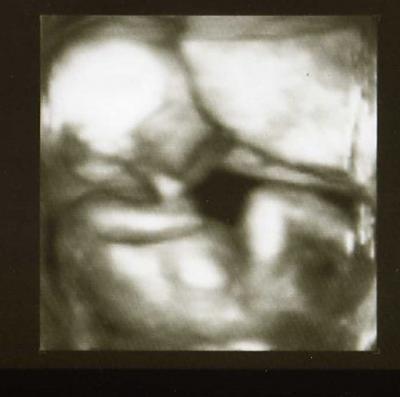 Bild zu Hallo meine Lieben :-) - Forum für August - Mamis