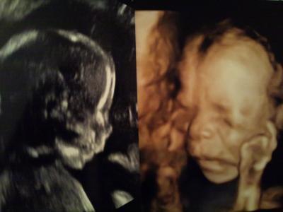 Bild zu Foto von der FD!!! - Forum für August - Mamis