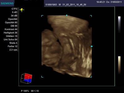 Bild zu War beim 3 d und 4 d Ultraschall  2 Stundenlang - Forum für August - Mamis