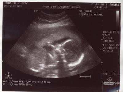 Bild zu Darf ich vorstellen? - Forum für August - Mamis