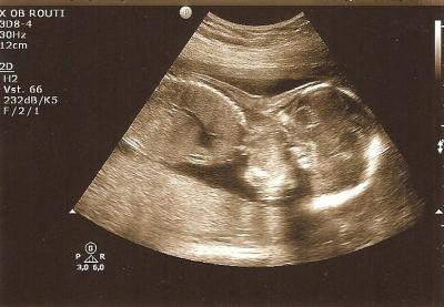 Bild zu Outing und FD - Forum für August - Mamis