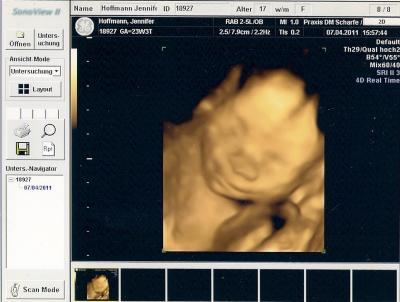 Bild zu zurück vom frauenarzt - Forum für August - Mamis