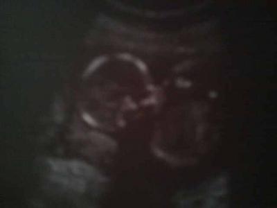 Bild zu Babyfoto - Forum für August - Mamis