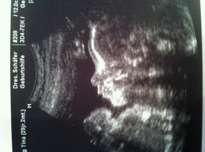 Bild zu Fotos vom heutigen FA Besuch :) - Forum für August - Mamis