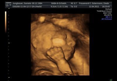 Bild zu ein paar Bildchen vom 3D-Ultraschall..... - Forum für August - Mamis