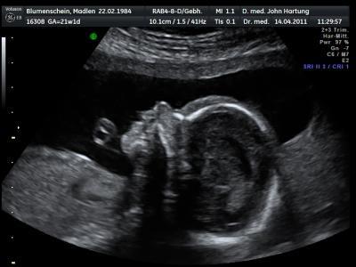 Bild zu Zurück von FD... - Forum für August - Mamis