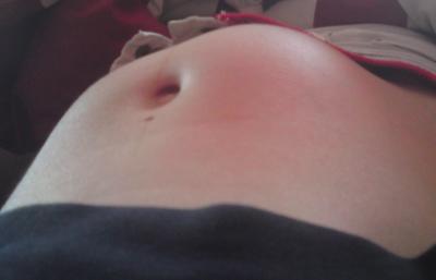 Bild zu Beule - Forum für August - Mamis