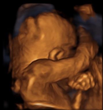 Bild zu 3D Bilder :) - Forum für August - Mamis