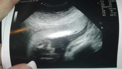 Bild zu endlich ein outing - Forum für August - Mamis