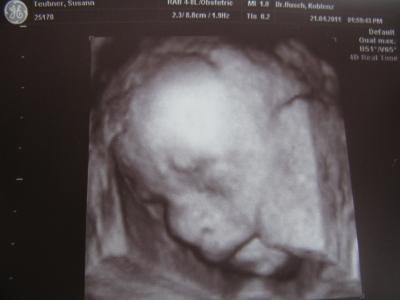 Bild zu Zurück von der FD - Forum für August - Mamis