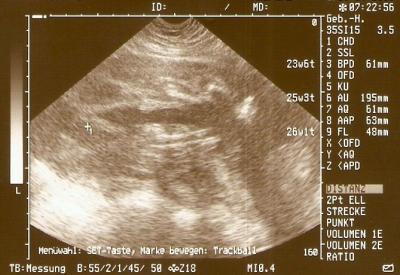 Bild zu Raten wir gemeinsam - Forum für August - Mamis