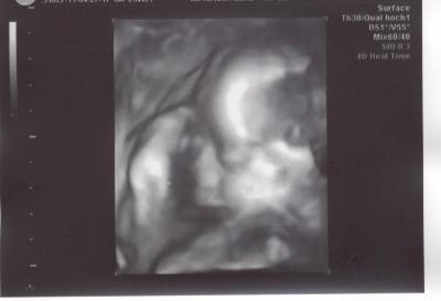 Bild zu 3D US - Forum für August - Mamis