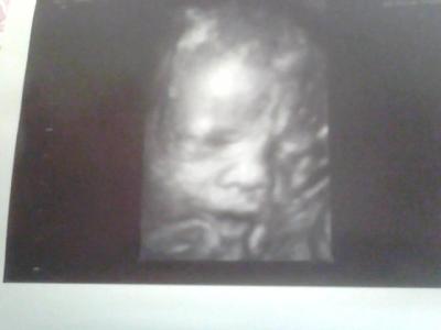 Bild zu darf ich euch meinen sohn vorstellen.....das ist lennox - Forum für August - Mamis