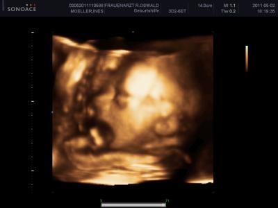 Bild zu Zurück vom 3D;) - Forum für August - Mamis