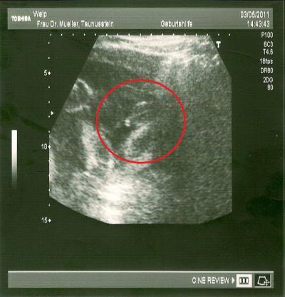 Bild zu Auch mal melden mag :) - Forum für August - Mamis