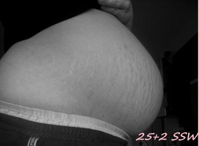 Bild zu Mein Bauch....leider mit Streifen =((( - Forum für August - Mamis