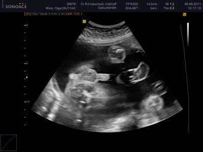 Bild zu Zurück vom FA - Forum für August - Mamis