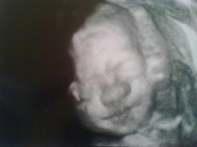 Bild zu Gestern FA-Termin! =) - Forum für August - Mamis