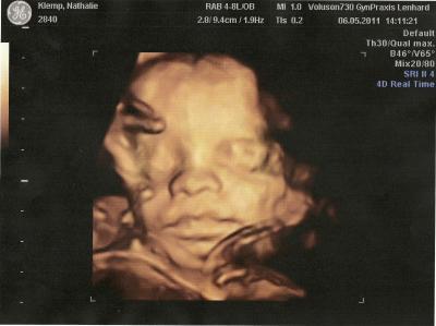 Bild zu Wollte euch mal meinen süssen vorstellen - Forum für August - Mamis