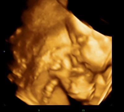 Bild zu Zurück von VU mit Bildchen :-) - Forum für August - Mamis