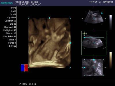 Bild zu Ein Bildchen - Forum für August - Mamis