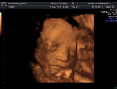 Bild zu Meine Prinzessin 3D :) - Forum für August - Mamis