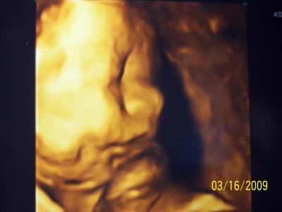 Bild zu Juhuu, letzter Ultraschall gemacht. - Forum für August - Mamis