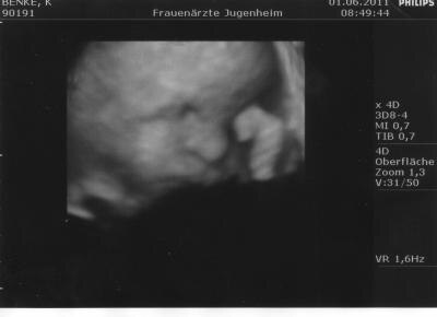 Bild zu Zurück von VU mit Bild - Forum für August - Mamis