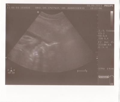 Bild zu heute VU - und ich bin überglücklich ... - Forum für August - Mamis